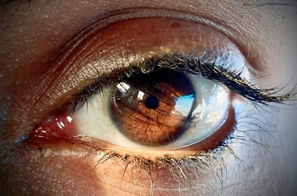 Your Eyes, Your Life (3): The Silent Eye Diseases You Should Not Ignore